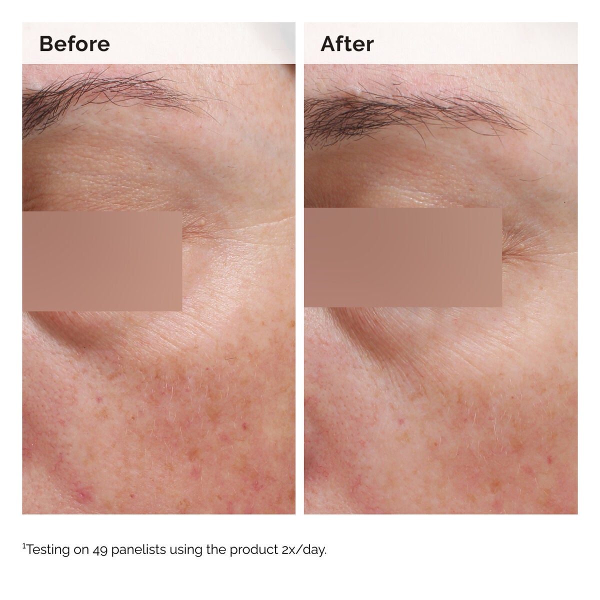 niacinamide-5-face-and-body-emulsion-e9 2024-08-23-ORD-Nia-5pct-Face-Body-B-A-Elasticity-Global-02-1x1.jpg