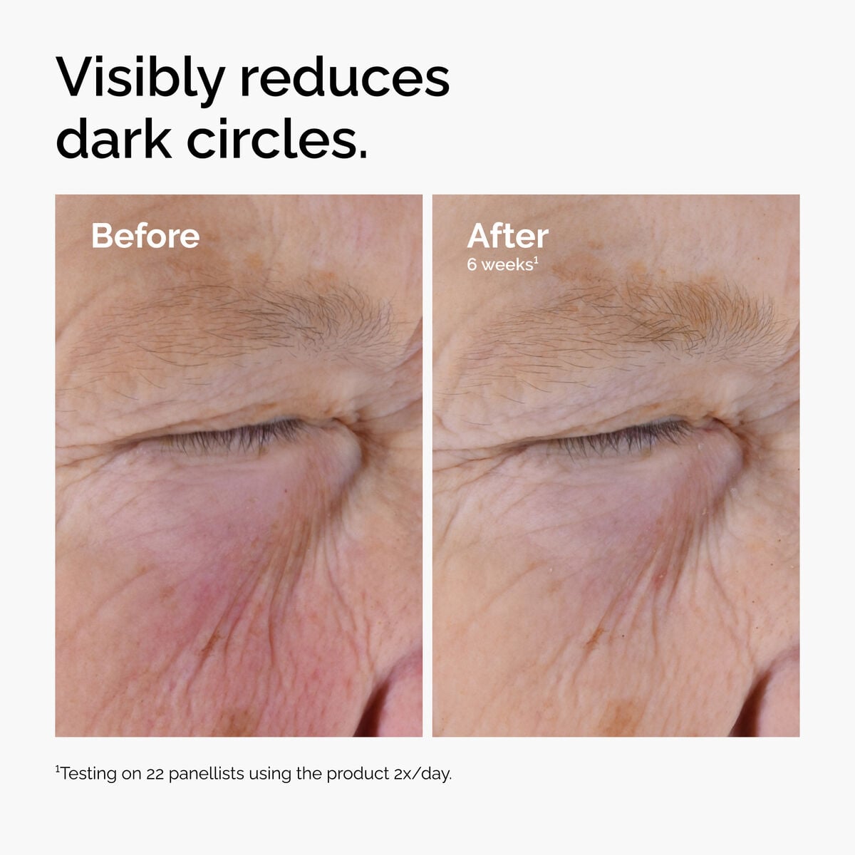caffeine-solution-5-egcg-eye-serum-b7 ord-caffeine-solution-egcg-dark-circles-before-after.jpg