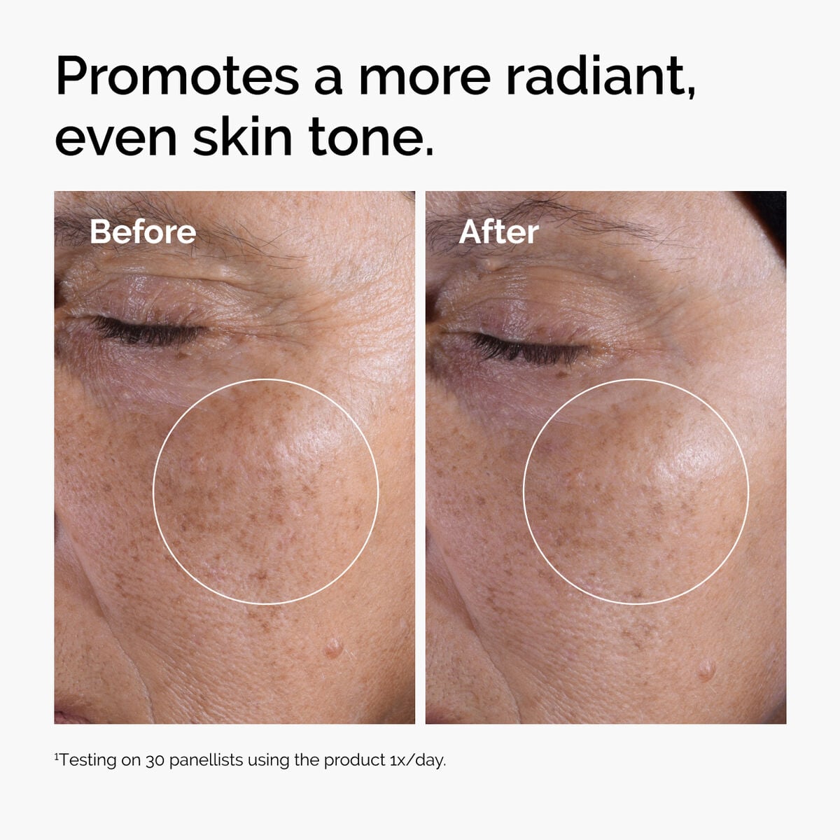 glycolic-acid-7-exfoliating-toner-m2 ord-glycolic-before-after-radiance.jpg