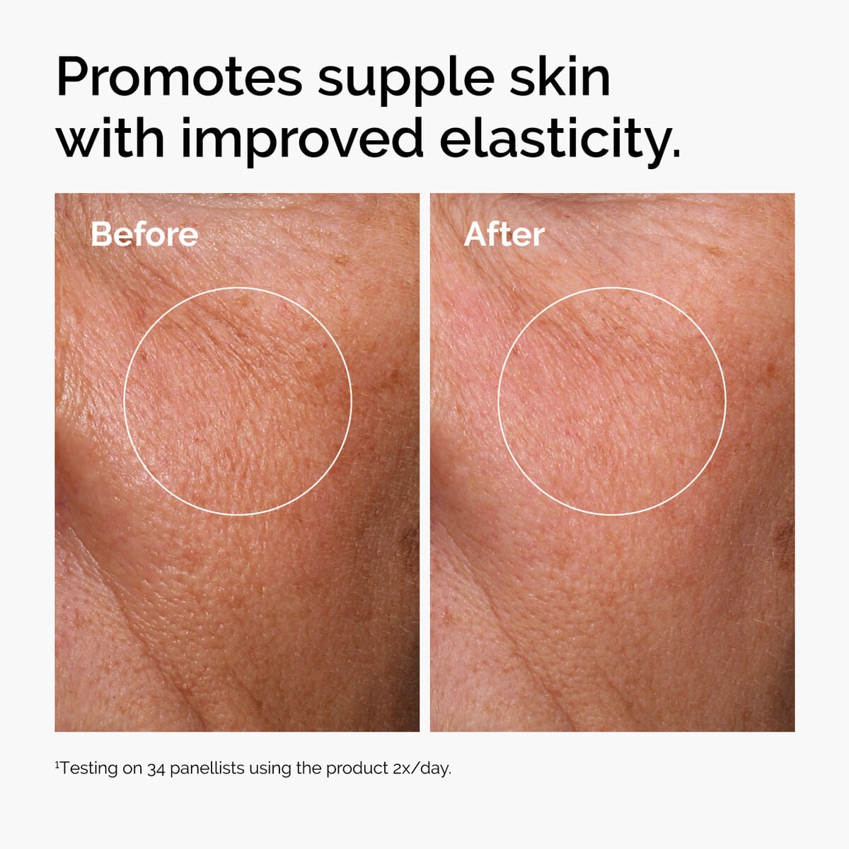 hyaluronic-acid-2-b5-with-ceramides-x9 ord-hyaluronic-acid-2pct-b5-hydrating-serum-before-after-elasticity.jpg
