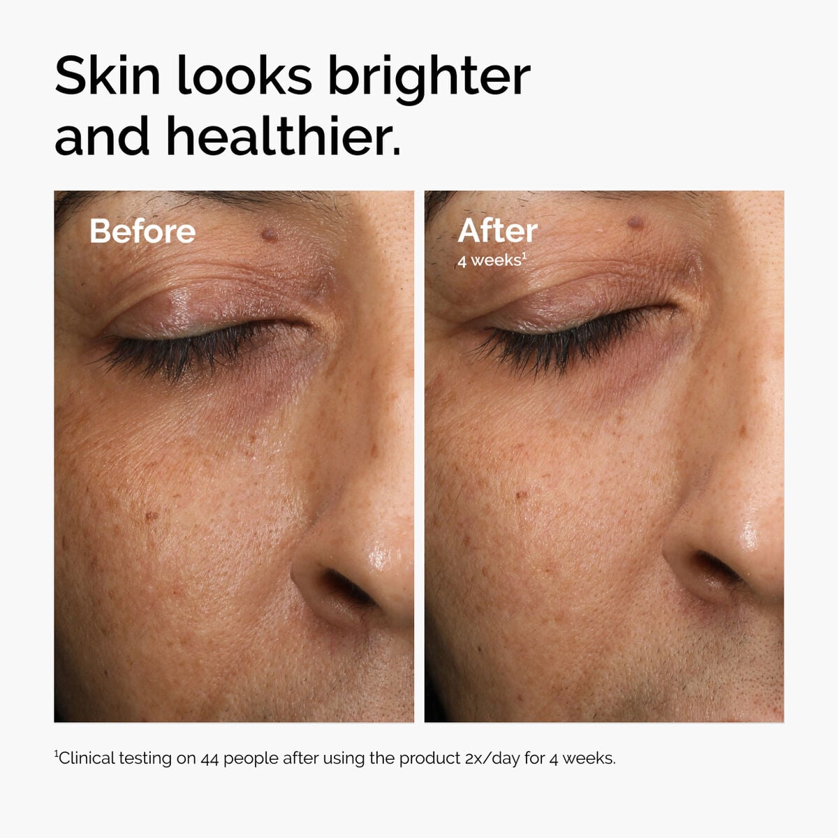 multi-antioxidant-radiance-serum-p0 ord-mars-before-after-healthy.jpg