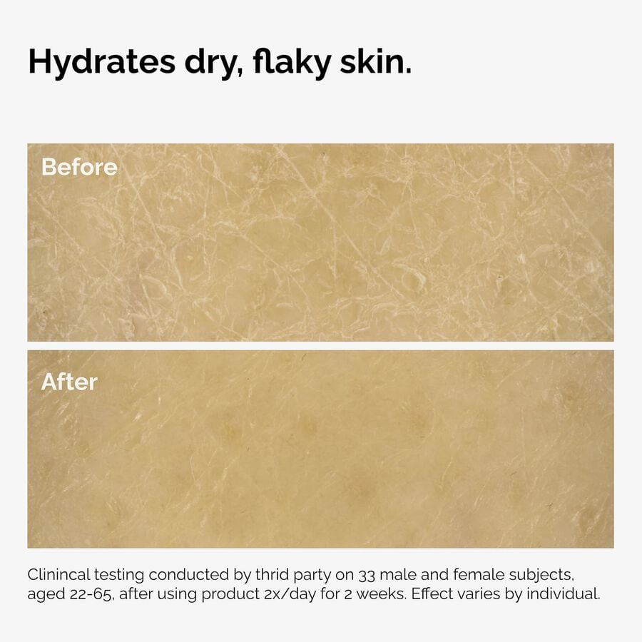 the-body-care-collection-u5 ord-natural-moisturizing-factors-inulin-body-before-after-graphic-02.jpg