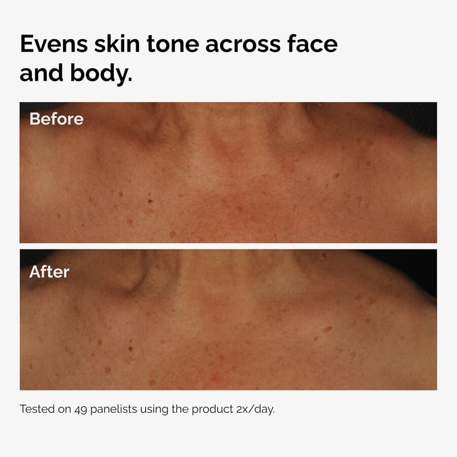 the-body-care-collection-u5 ord-niacinamide-face-body-serum-before-after-even-tone-graphic.jpg